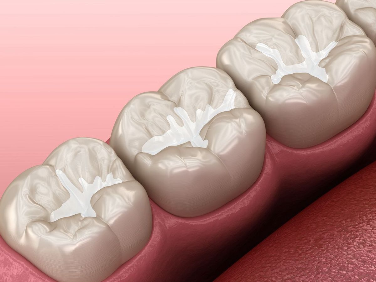 Hydroxyapatite vs. Fluoride: Best Toothpaste for Cavity Repair