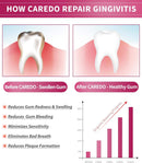 CAREDO Gingivitis Toothpaste Gum Repair for Bleeding Gums, Swollen Gums Treatment for Gum Sensitivity, Gingivitis Treatment for Gum Disease, Reverse Gingivitis Treatment for Adults Oral Care, 3.52OZ