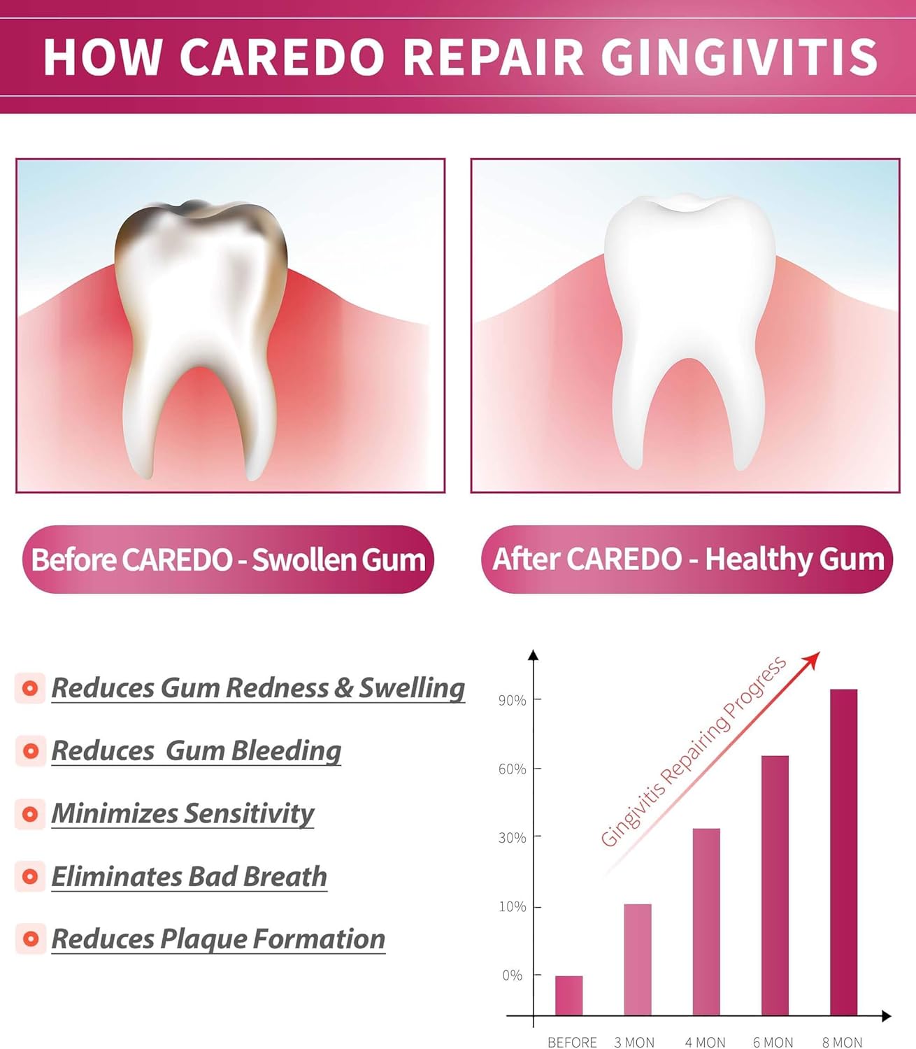 CAREDO Gingivitis Toothpaste Gum Repair for Bleeding Gums, Swollen Gums Treatment for Gum Sensitivity, Gingivitis Treatment for Gum Disease, Reverse Gingivitis Treatment for Adults Oral Care, 3.52OZ