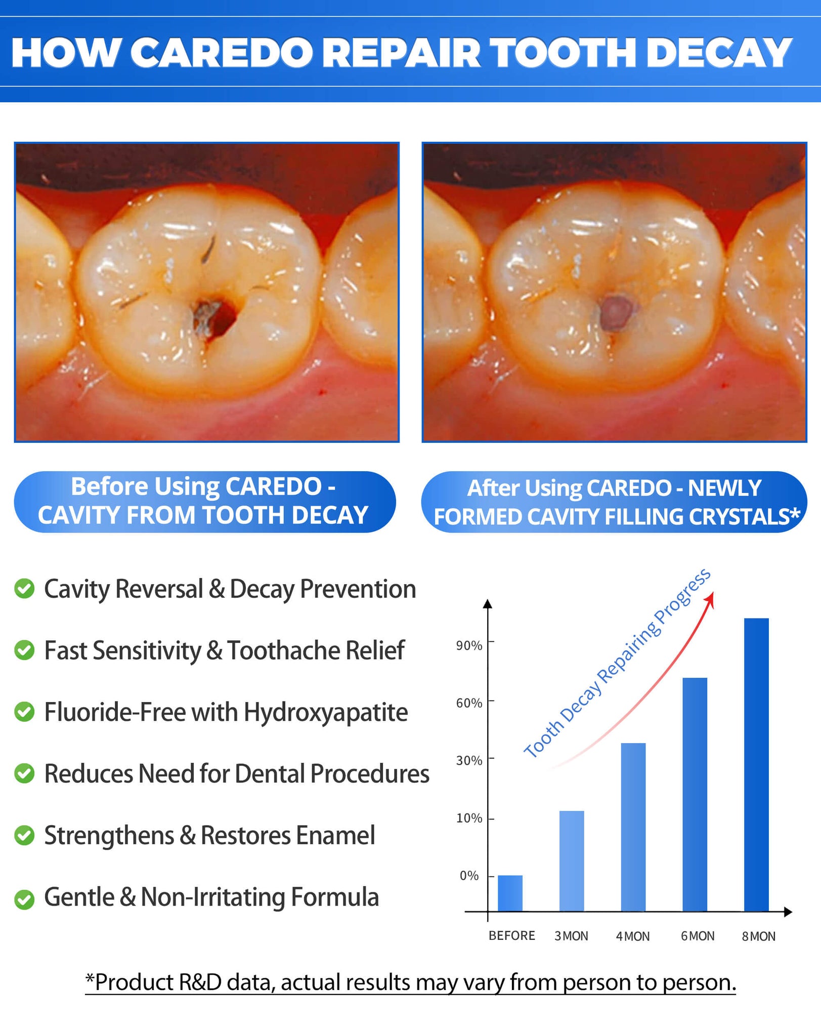 CAREDO Fluoride-Free Hydroxyapatite Toothpaste for Cavity Repair | Natural Enamel Remineralizing Toothpaste for Adults – Reverse Cavities at Home (3.52oz)