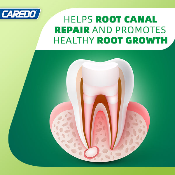 CAREDO Toothpaste Gum Repair for Avoid Root Canal Therapy, Gingivitis Treatment for Pulpitis Discomforts and Tooth Repair, Remineralizing Hydroxyapatite Toothpaste for Root Canal Discomforts, Mint 3.52 OZ