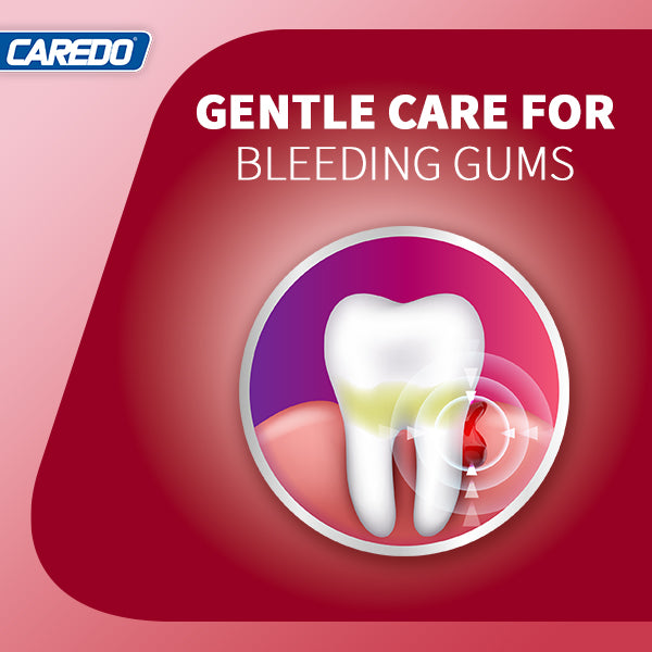 CAREDO Gingivitis Toothpaste Gum Repair for Bleeding Gums, Swollen Gums Treatment for Gum Sensitivity, Gingivitis Treatment for Gum Disease, Reverse Gingivitis Treatment for Adults Oral Care, 3.52OZ