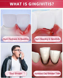 CAREDO Gingivitis Toothpaste Gum Repair for Bleeding Gums, Swollen Gums Treatment for Gum Sensitivity, Gingivitis Treatment for Gum Disease, Reverse Gingivitis Treatment for Adults Oral Care, 3.52OZ