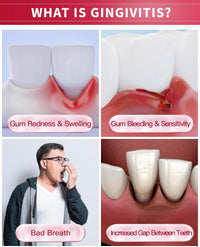 CAREDO Gingivitis Toothpaste Gum Repair for Bleeding Gums, Swollen Gums Treatment for Gum Sensitivity, Gingivitis Treatment for Gum Disease, Reverse Gingivitis Treatment for Adults Oral Care, 3.52OZ