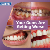CAREDO 20% Stronger Gum Repair Toothpaste