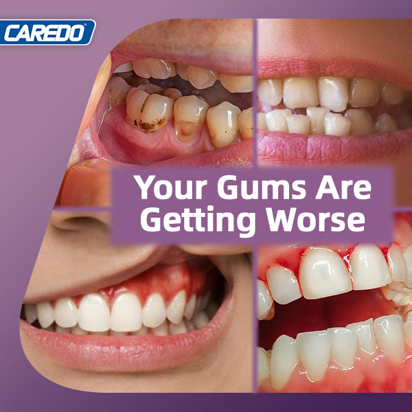 CAREDO 20% Stronger Gum Repair Toothpaste
