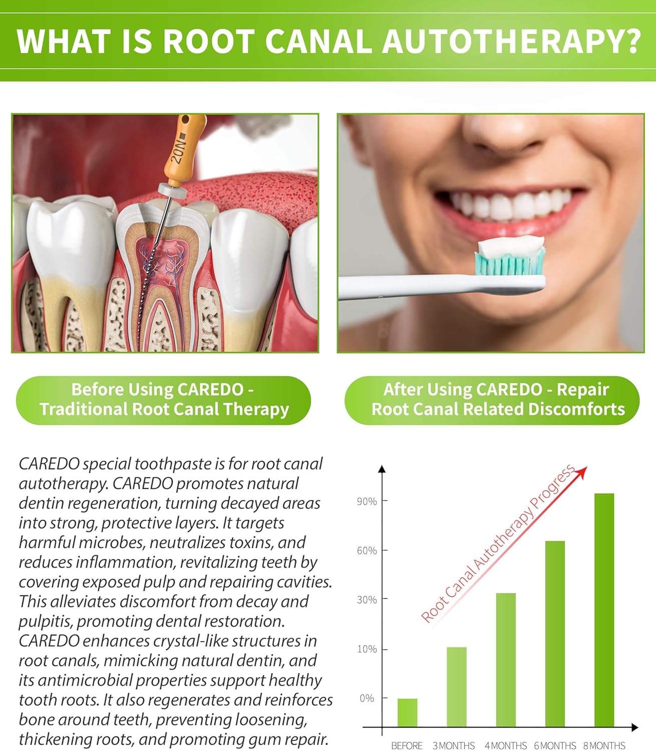 CAREDO Toothpaste Gum Repair for Avoid Root Canal Therapy, Gingivitis Treatment for Pulpitis Discomforts and Tooth Repair, Remineralizing Hydroxyapatite Toothpaste for Root Canal Discomforts, Mint 3.52 OZ