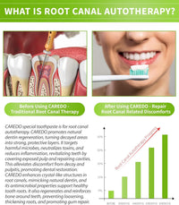 CAREDO Toothpaste Gum Repair for Avoid Root Canal Therapy, Gingivitis Treatment for Pulpitis Discomforts and Tooth Repair, Remineralizing Hydroxyapatite Toothpaste for Root Canal Discomforts, Mint 3.52 OZ
