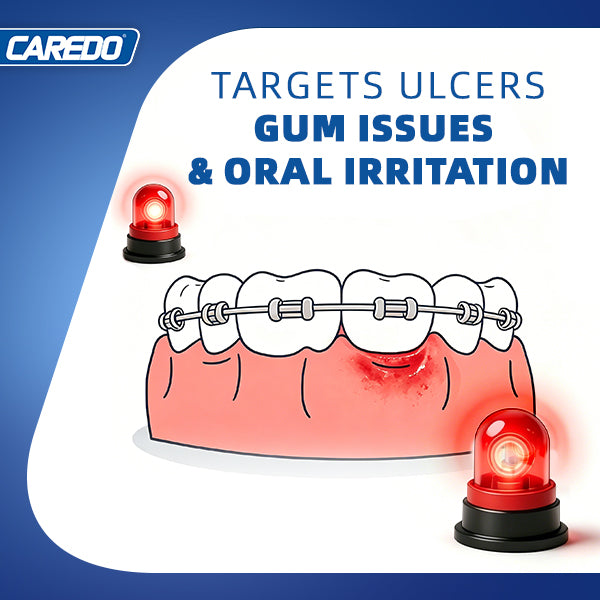 CAREDO Soothing Cream – Stop Tooth & Gum Pain Fast