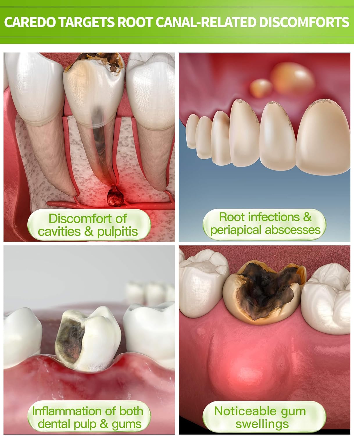 CAREDO Toothpaste Gum Repair for Avoid Root Canal Therapy, Gingivitis Treatment for Pulpitis Discomforts and Tooth Repair, Remineralizing Hydroxyapatite Toothpaste for Root Canal Discomforts, Mint 3.52 OZ