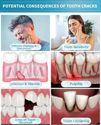 CAREDO Healing Teeth Crack Toothpaste - Repairing Cracked Teeth Enamel, Remineralizing Toothpaste 100g