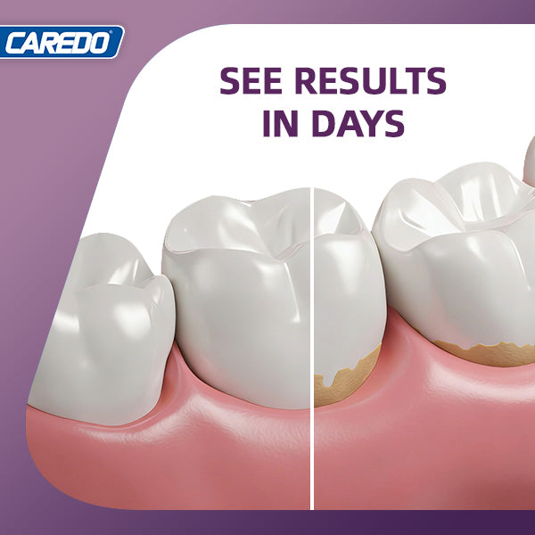 CAREDO 20% Stronger Gum Repair Toothpaste